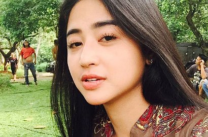 Soal Efek Samping Sulam Bibir, Dewi Persik: Gak Bisa Ciuman Dulu