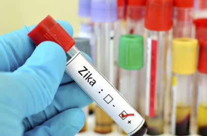 Seorang Suku Anak Dalam dan Wisatawan Asing Terinfeksi Zika