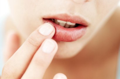 Intip 10 Masker Alami Ampuh Atasi Bibir Kering dan Pecah-Pecah