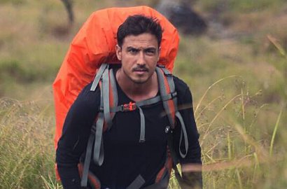 Waduh, Hamish Daud Pernah Kecelakaan Parah Hingga Amnesia 9 Bulan
