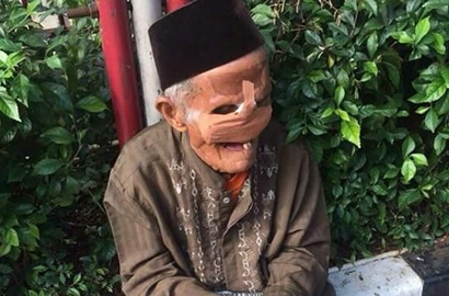 Kena Kanker Wajah, Beginilah Kisah Miris Kakek Penjual Koran di Kokas