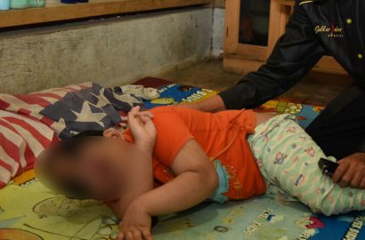 Hidup Tanpa Tempurung Kepala, Bocah 6 Tahun di Ciamis Dinyatakan Sehat