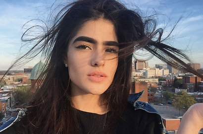Sering Dibully Karena Alis Shin-chan, Gadis Ini Malah Jadi Model