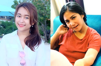 Adik Ayu Ting Ting Diejek Lengan 'Kuli', Marsha Secantik Nagita Usai Comeback Instagram