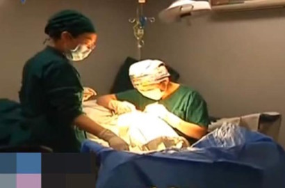 Bikin Ngeri, Payudara Wanita Ini Turun dan 'Jatuh' ke Perut