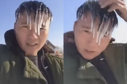 Terlalu Dingin, Rambut Pria Ini Berubah Jadi Es