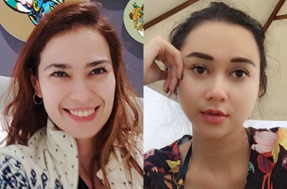 Adu Cantik Bareng Catherine Wilson, Dada Aura Kasih Bikin Salah Fokus
