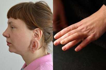 Ada Cincin Jari dan Anting Bentuk Telinga, Keren atau Jijik?
