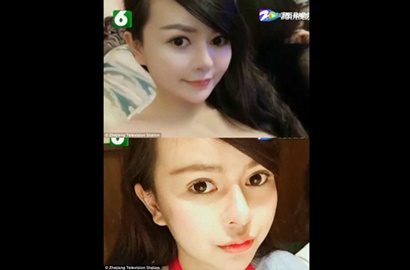 Terlalu Cantik, Wanita Ini Dicakar-Cakar Temannya Usai Oplas