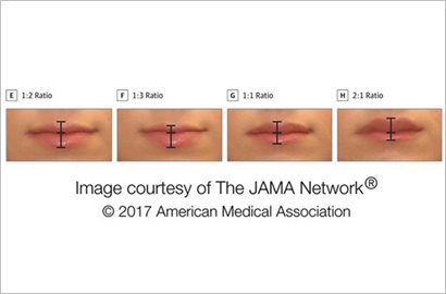 Ingin Dapatkan Predikat Bibir Seksi? Inilah Formula yang Bisa Dicontoh