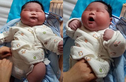 Serupa Porsi Kembar, Bayi Berat 6,7 Kg Ini Lahir di Tiongkok