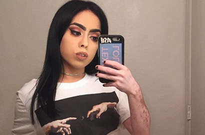 Derita Vitiligo, Gadis Cantik Ini Pede Bikin Gambar Peta di Tubuhnya