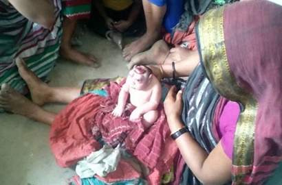 Terlahir Langka, Bayi Mirip Alien Ini Malah Dianggap Titisan Dewa