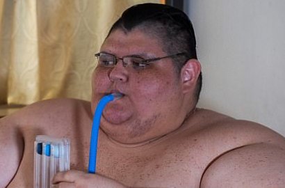 Miliki Berat Badan 595 Kg, Pria Ini Hanya Mampu Terbaring di Kasur