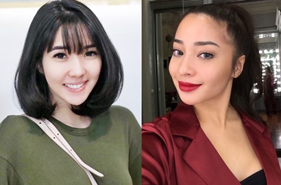 Gisella dan Nikita Willy Ketahuan Filler Dagu, Netter: Orang Kaya Mah Bebas