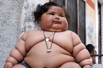 Baru 8 Bulan, Bobot Bayi di India Ini Capai 20 Kg