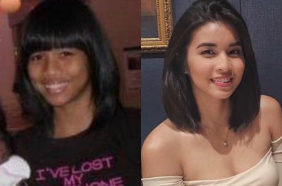 Dulu Buruk Kini Rupawan, Netizen Tak Percaya Perubahan Wanita Ini