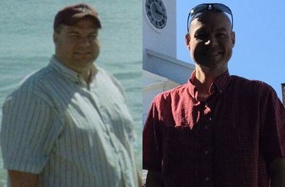 Pakai Aplikasi Ponsel, Pria Ini Berhasil Libas Lemak 80 Kg