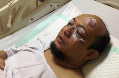 Kepolisian Klaim Punya Titik Terang Kasus Penyerangan Novel, Apa?