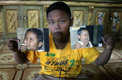 Masih Ingat Ardi Rizal Balita Perokok 40 Batang Per Hari? Ini Kondisinya Sekarang