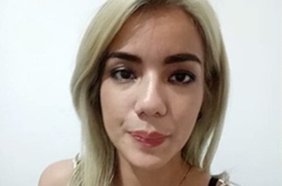 Luka Parah di Wajah dan Kepala, Sheila Marcia Diminta Dokter Operasi Plastik