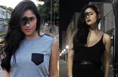 Miliki Tanda Lahir Superbesar di Wajah, Wanita Ini Nggak Malu dan Malah Jadi Model Terkenal