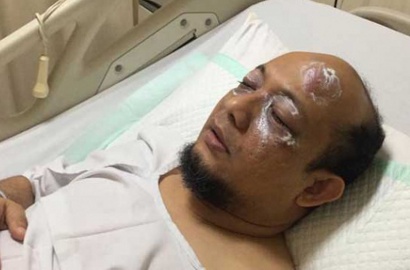 Lakukan Tes Baca Huruf dan Angka, Novel Baswedan Korban Air Keras Membaik