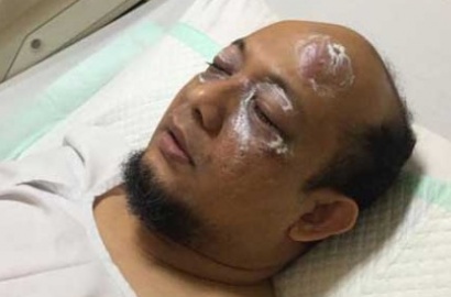 Kasus Penyiraman Air Keras Novel Baswedan, Polisi Akhirnya Tangkap AL