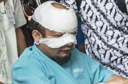 AL di Rumah Pada Saat Kejadian, Polisi Gagal Lagi Tangkap Pelaku Teror Novel?