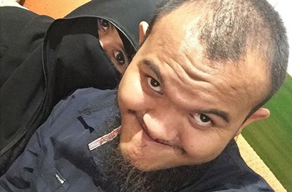 Berobat Penyakit Kulit ke Perancis, Istri Caisar 'YKS' Makin Membaik