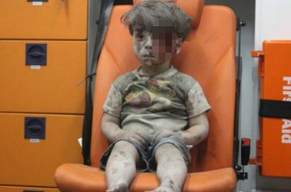 Disorot Lantaran Foto Berlumuran Darah, Begini Penampakan Bocah Suriah Omran Daqneesh Kini