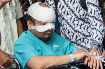 Dua Bulan Penyerangan Air Keras, Begini Kondisi Novel Baswedan Terkini