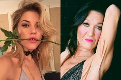 Meski Fisik Tak Sempurna, 8 Model Hebat Ini Buktikan Kalau Definisi Cantik Adalah Milik Semua Wanita