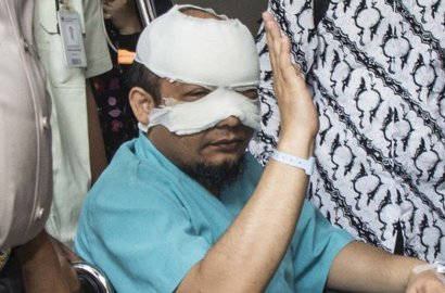 Segera Bawa Sketsa Wajah Pelaku Penyiraman Ke Novel, Polisi Tunggu Izin Dokter