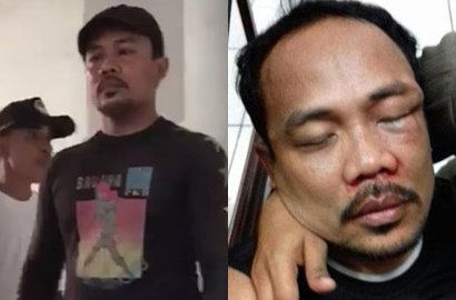 Usai Bawa Gergaji dan Kapak Bubarkan Kebaktian Anak-Anak, Joker Kini Bonyok Dipukuli Orang