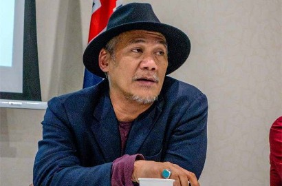 Sempat Ditabrak Mobil dan Dapat 30 Jahitan, Kaki Tio Pakusadewo Alami Infeksi