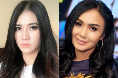 Ketemu Via Vallen, Yuni Shara Beber Fakta Mengejutkan Ini Soal Umur