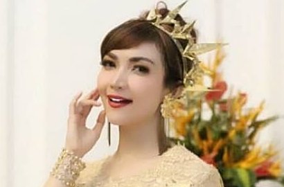 Cantik Pose Bak Barbie, Kaki 'Bengkong' Roro Fitria Bikin Salah Fokus