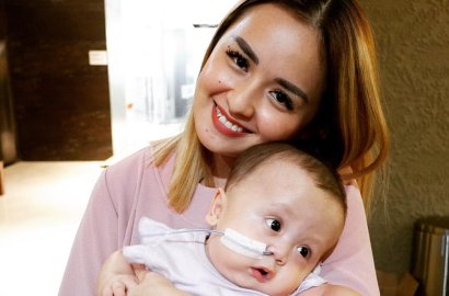 Derita Penyakit Langka, Anak Joanna Alexandra Ditangani 10 Dokter