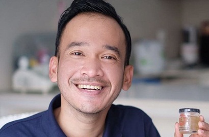 Ruben Onsu Singgung Gigi Veneer dan Operasi Hidung Ditanya 'Artis Alay', Sindir Siapa?