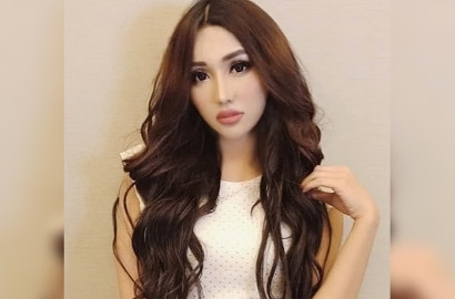 Lucinta Luna Akhirnya Akui Operasi Plastik, Masih Bantah Isu Transgender?