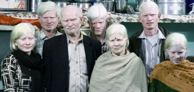 serba serbi albino