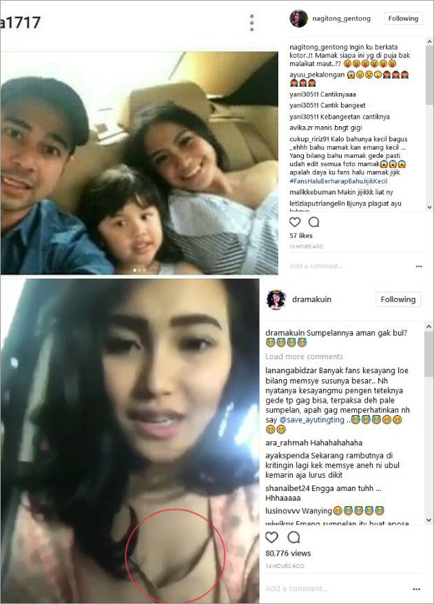 Ayu Ting Ting vs Nagita