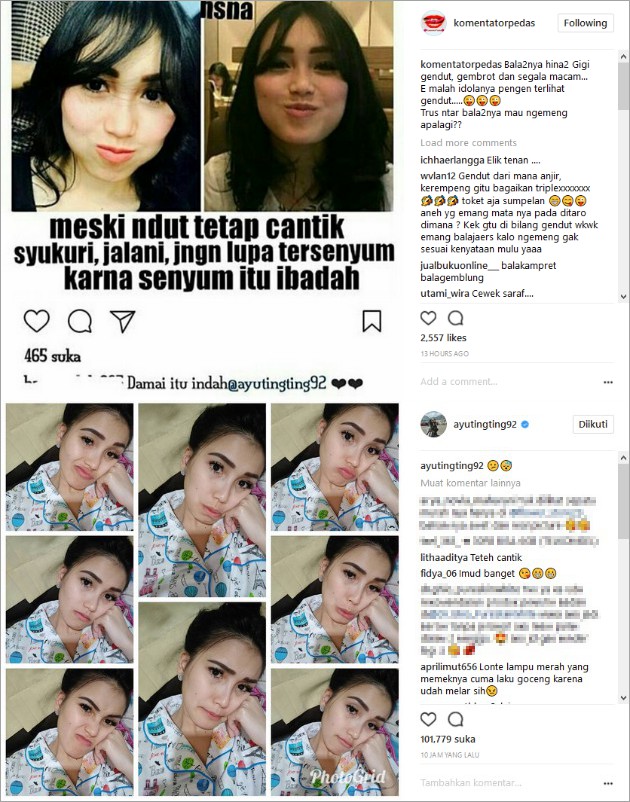 Ayu Ting Ting