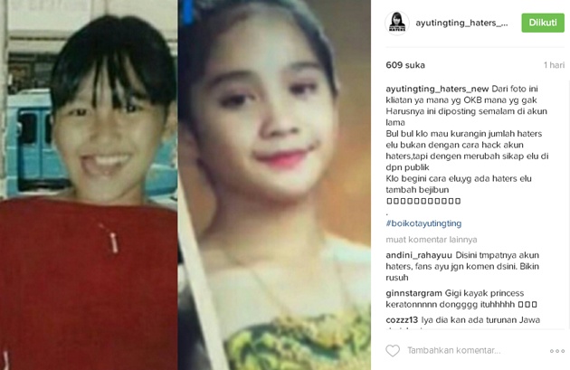 Masa Kecil Ayu dan Gigi