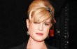 Kelly Osbourne Bersedia Operasi Kalau Kakinya Sudah Lumpuh