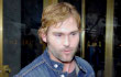 Seann William Scott Secara Sukarela Jalani Perawatan Medis