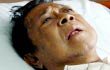 38 Tahun Mengidap Gagal Ginjal, Kris Biantoro Belum Bersedia Cari Pendonor