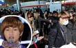 Cedera Kaki, Onew SHINee Absen di 'Music Bank' Paris