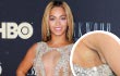 Bulu Ketiak Beyonce Ngintip Jadi Perhatian Media
